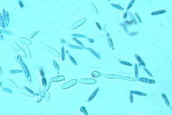 酵母菌的繁殖方式，分别介绍芽殖、裂殖、芽裂、孢子繁殖
