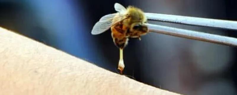 被蜜蜂蛰抹牙膏有用吗，被蜜蜂蛰了该怎么处理